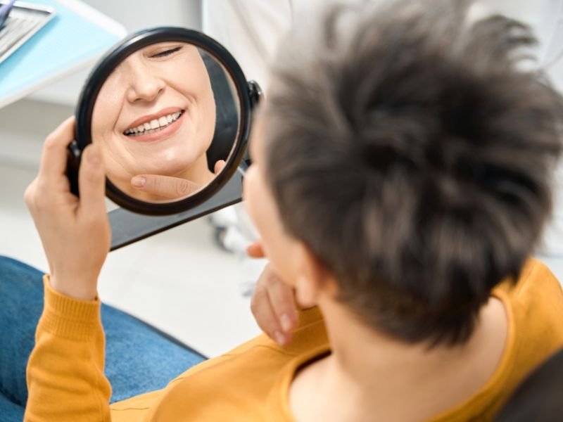 Smile makeover